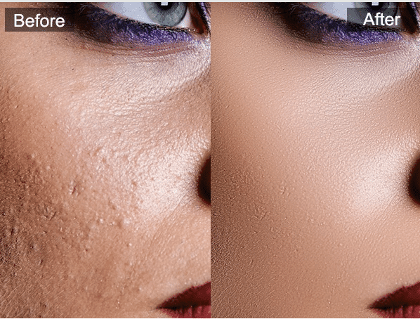 كيف يعمل SkinFiner؟